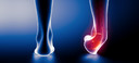 Entorse de tornozelo pode levar a lesões crônicas